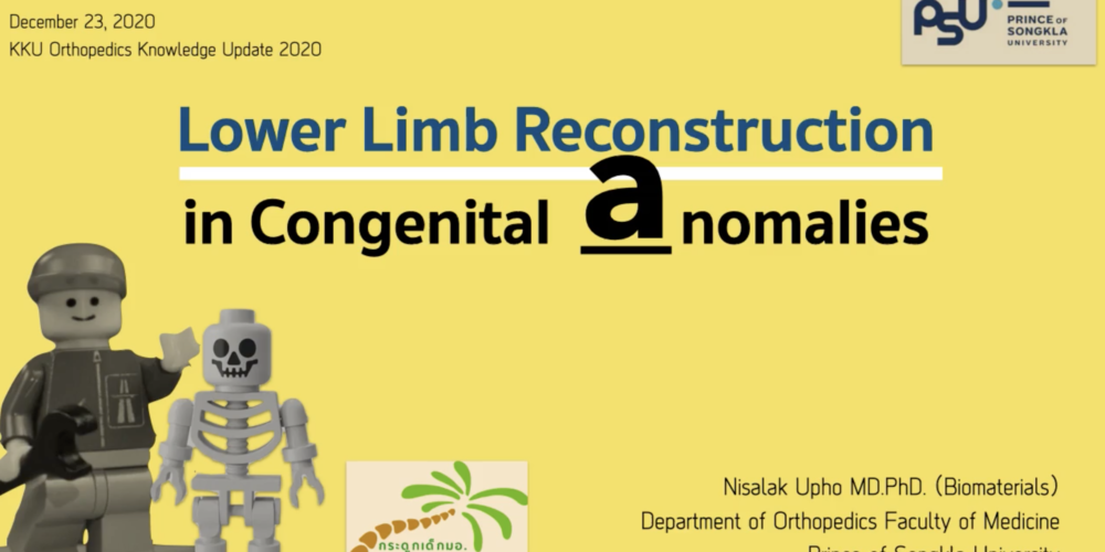 lowerrecon lowerrecon