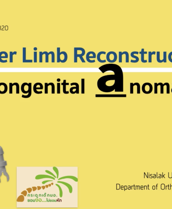 lowerrecon
